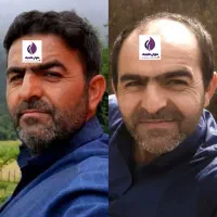 تخفیف پاییز تا یلدا کاشت مو و ابرو و مژه|خدمات آرایشگری و زیبایی|زاهدان, |دیوار