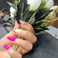 کاشت ترمیم هزاریکشب