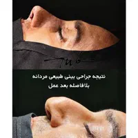 جراحی زیبایی اقساط|خدمات آرایشگری و زیبایی|تهران, امیریه|دیوار