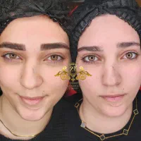 میکروبلیدینگ و فیبروز ابرو شیدینگ لب و کاور تتو