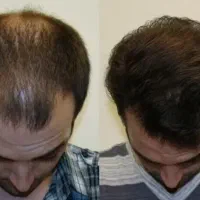 این اقدام اخریشه و دیگه نیازی نیست به اقدام دیکه