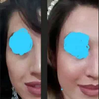 کلینیک پوست ،مو و زیبایی جوانسازی حرفه ای فرسیما
