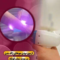 لیزر موهای زائد