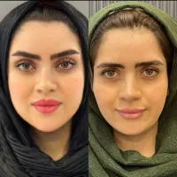 تخفیف به مناسبت روز مادر /ژل لب- کانتورینگ- بوتاکس|خدمات آرایشگری و زیبایی|مشهد, ایثار|دیوار