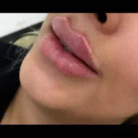 آموزش ژل وبوتاکس|خدمات آرایشگری و زیبایی|اهواز, فاز ۲ پادادشهر|دیوار