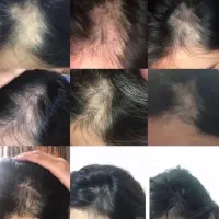 موهات خیلی خیلی کلفت و محکم میشه