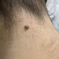 پلکسر خالبرداری حرفه ای