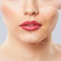 لیزر موهای زائد کلینیک پرهام