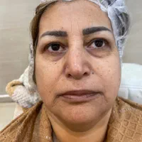 مدل پاکسازی پوست و نوردرمانی