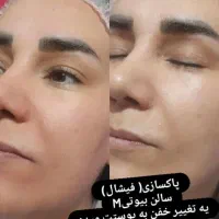 تخفیفات عید تا عید فیشیال(پاکسازی) صورت