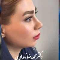 جراحی بینی ۲۹ میلیون فقط ۸ اذر|خدمات آرایشگری و زیبایی|قم, بکایی|دیوار