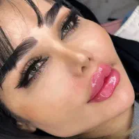 تزریق ژل ،پی ارپی ، بایوفیلربدون سوزن ودرد