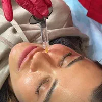 آموزش پیشرفته فیلر(ژل)،بوتاکس،لیفت نخ|خدمات آموزشی|تهران, نیاوران|دیوار