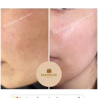 پاکسازی و فیشیال(فیشال)،آلگاپیل،تکنیک پوست کره‌ای