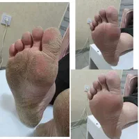 نیازمندمدل پدیکور