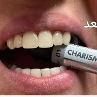 کامپوزیت دندان جشنواره ی تخفیفات تا شب یلدا