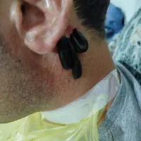 تزریقات سرم فصد حجامت سونداژ زالو کلیه مناطق تهران|خدمات آرایشگری و زیبایی|تهران, فلسطین (میدان انقلاب)|دیوار