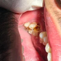 دندان پزشکی باقیمت های باورنکردنی (همراه با ضمانت)