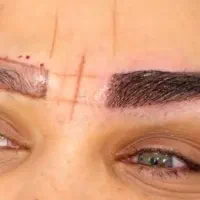 کاشت ابرو تکنیک تار به تار ترکیه با ۱۵ ت