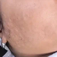 آموزش و فیشیال تخصصی از صفر تا ورود به بازار کار|خدمات آموزشی|آبادان, |دیوار