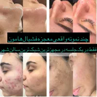 فشیال معجزه ۳سال جوان شوید