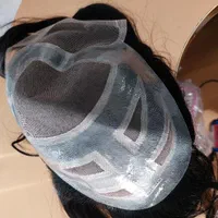 پروتز مو|آرایشی، بهداشتی، درمانی|تهران, نارمک|دیوار