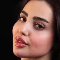 تزریق ژل لب روسی بوتاکس چشم گربه ای فیلرزیرچشم|خدمات آرایشگری و زیبایی|تهران, ستارخان|دیوار