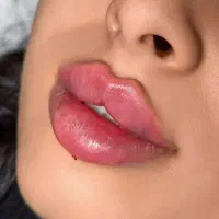 تزریق ژل و بوتاکس .کانتوریگ صورت .زاویه سازی|خدمات آرایشگری و زیبایی|بروجن, |دیوار