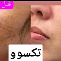 پاکسازی کبد و اصلاح مزاج لاغری پوست مو چاقی صورت|آرایشی، بهداشتی، درمانی|فردیس, شهرک ۱۱۰|دیوار