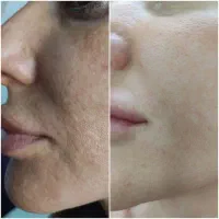 خدمات تخصصی پاکسازی پوست