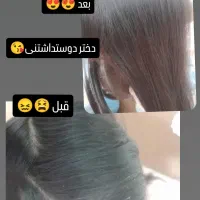 درمان رشک و شپش قطعی وتضمینی