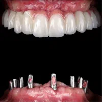 درمانگاه دندانپزشکی تخصصی دکتر دانشور|خدمات آرایشگری و زیبایی|شیراز, معالیآباد|دیوار