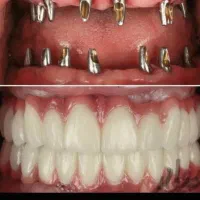 برطرف کردن تمام عیوب دندان|آرایشی، بهداشتی، درمانی|سیرجان, |دیوار