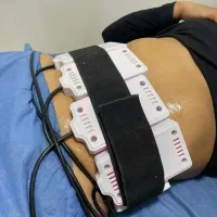 لاغری بدون جراحی با دستگاه کرایولیپولیز|خدمات آرایشگری و زیبایی|گرگان, |دیوار