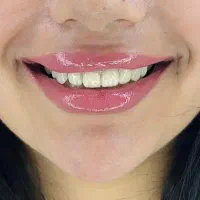 خدمات دندانپزشکی