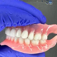 ساخت دندان یک روزه با ضمانت صدردصد