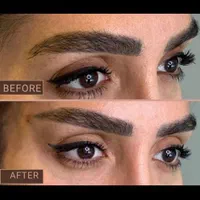 نخ جوان ساز/کاگ مونو/لیفت صورت شقیقه/نوبل/مدی لیفت|خدمات آرایشگری و زیبایی|شیراز, پودنک|دیوار