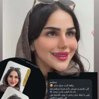 آف ویژه خدمات زیبایی ژل و بوتاکس فقط یک هفته