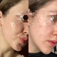 خوراکی برای سیستم ایمنی|خوردنی و آشامیدنی|تهران, شهرک آزمایش|دیوار