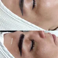 فیشیال تخصصی پوست