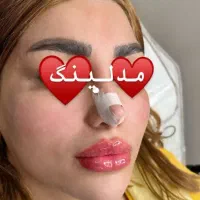 مدل ژل و بوتاکس رایگان فوری به مدت محدود