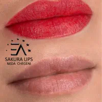 میکروبلیدینگ،فیبروز،شیدینگ،خط چشم. بن مژه