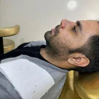 جشنواره جراحی بینی۲۵ تومن .جراحی صورت واندام|خدمات آرایشگری و زیبایی|اسلامشهر, شهرک مهدیه|دیوار