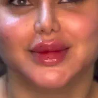 آف ژل وبوتاکس|خدمات آرایشگری و زیبایی|مسجد سلیمان, |دیوار