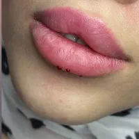 تزریق ژل و بوتاکس و مزو ژل|خدمات آرایشگری و زیبایی|فسا, |دیوار