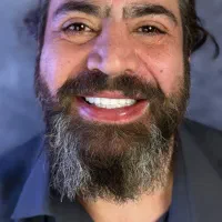 دندانپزشکی کامپوزیت تخفیف ویژه، عصب کشی، روکش|خدمات زیبایی و سلامت|تهران, سازمان برنامه شمالی|دیوار