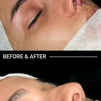 عمل جراحی بینی /لیفت صورت/پلک|خدمات آرایشگری و زیبایی|کرج, عظیمیه|دیوار