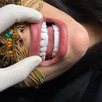 کامپوزیت روکش لمینت|خدمات آرایشگری و زیبایی|اندیشه, اندیشه فاز ۱|دیوار