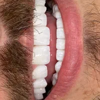 کامپوزیت|پزشکی|خرم‌آباد, |دیوار