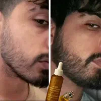 محلول پرطرفدار ریش بین آقایون